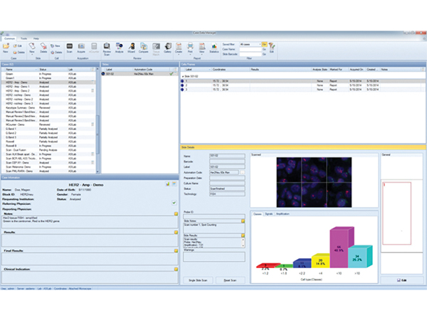 デジタル核型解析システム CytoPower 画像6