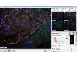 デジタル核型解析システム CytoPower 画像7