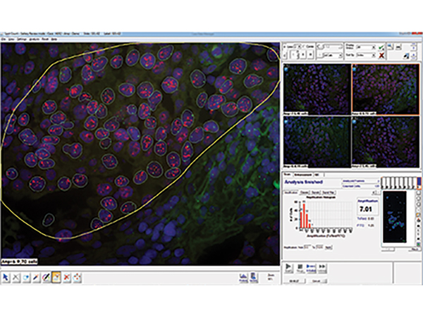 デジタル核型解析システム CytoPower 画像7
