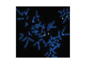 デジタル核型解析システム CytoPower 画像8