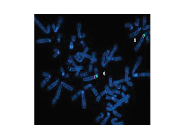 デジタル核型解析システム CytoPower 画像8