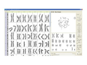 デジタル染色体分析システム HiBand 画像6