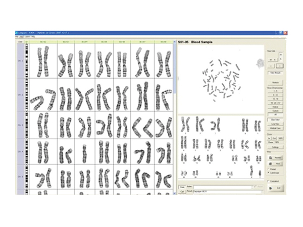 デジタル染色体分析システム HiBand 画像6