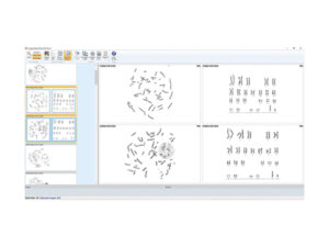 デジタル染色体分析システム HiBand 画像8