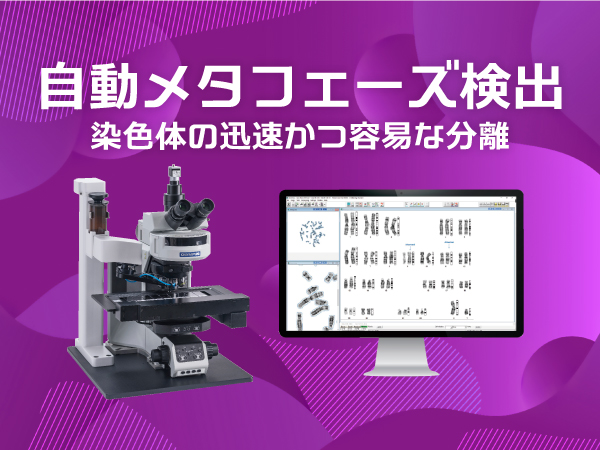 デジタル染色体分析システム HiBand 画像1
