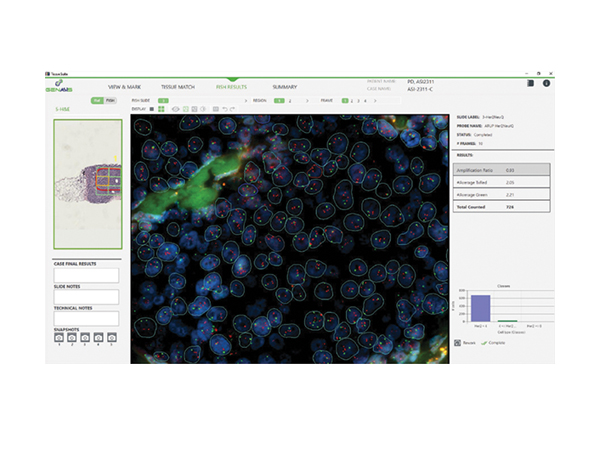 デジタル病理組織解析システム PathFusion 画像3