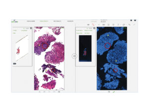 デジタル病理組織解析システム PathFusion 画像4