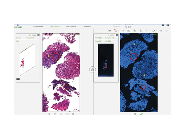 デジタル病理組織解析システム PathFusion 画像4