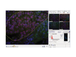 デジタル病理組織解析システム PathFusion 画像5