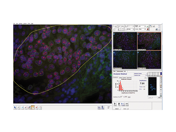 デジタル病理組織解析システム PathFusion 画像5