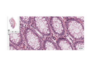 デジタル病理組織解析システム PathFusion 画像8