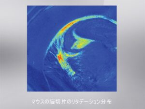 顕微複屈折イメージングシステム Exicor MicroImager 画像2