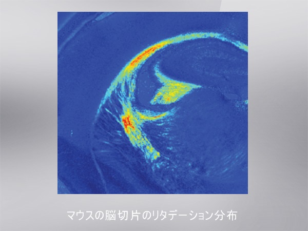 顕微複屈折イメージングシステム Exicor MicroImager 画像2