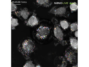 3D Cell Explorerシリーズ専用ソフトウェア「SMART LIPID DROPLET ASSAY」 画像2